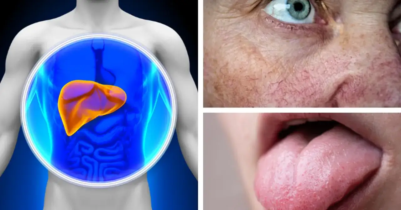 objawy chorej wątroby grafika