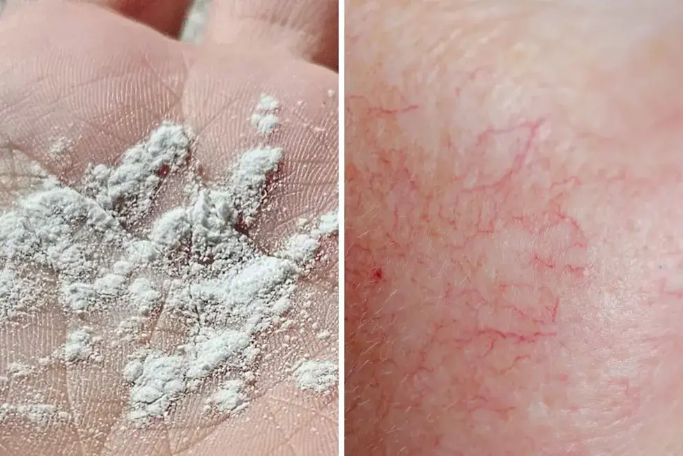 Zdjęcie Peeling enzymatyczny na suchą czy mokrą skórę – która metoda jest lepsza?