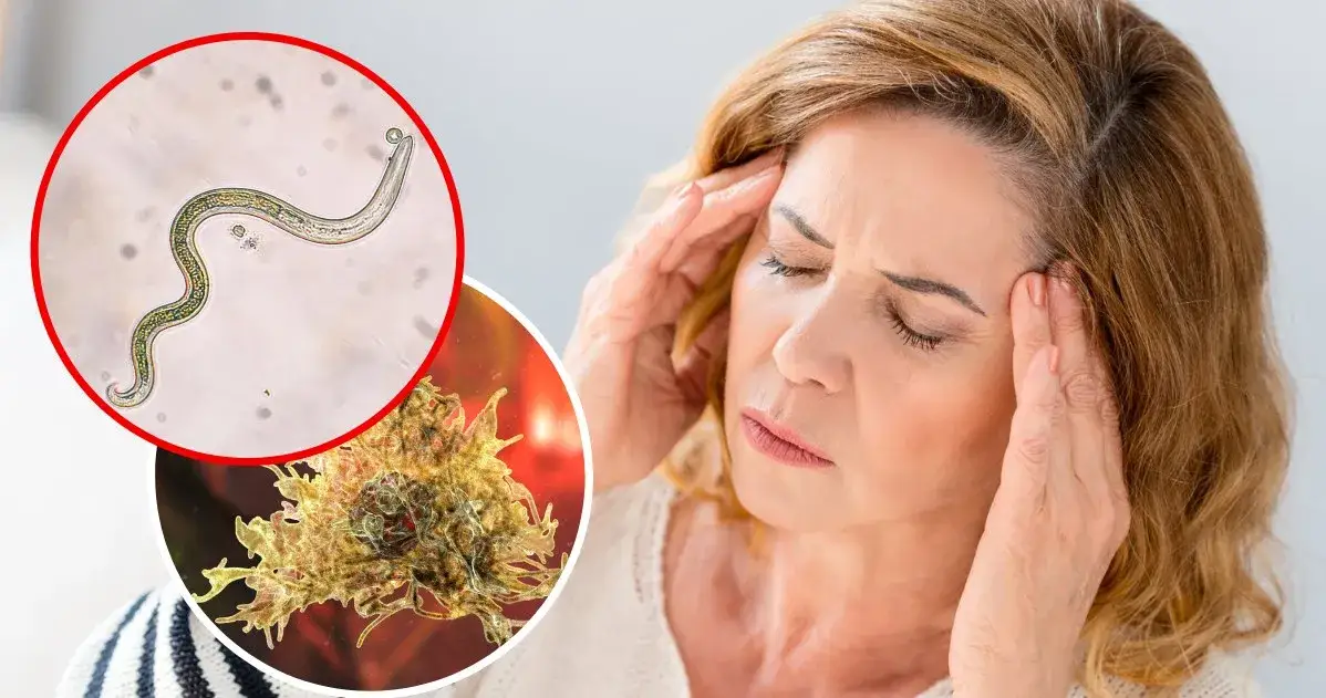 Zdjęcie Pasożyty w głowie: 5 niepokojących objawów u dorosłych