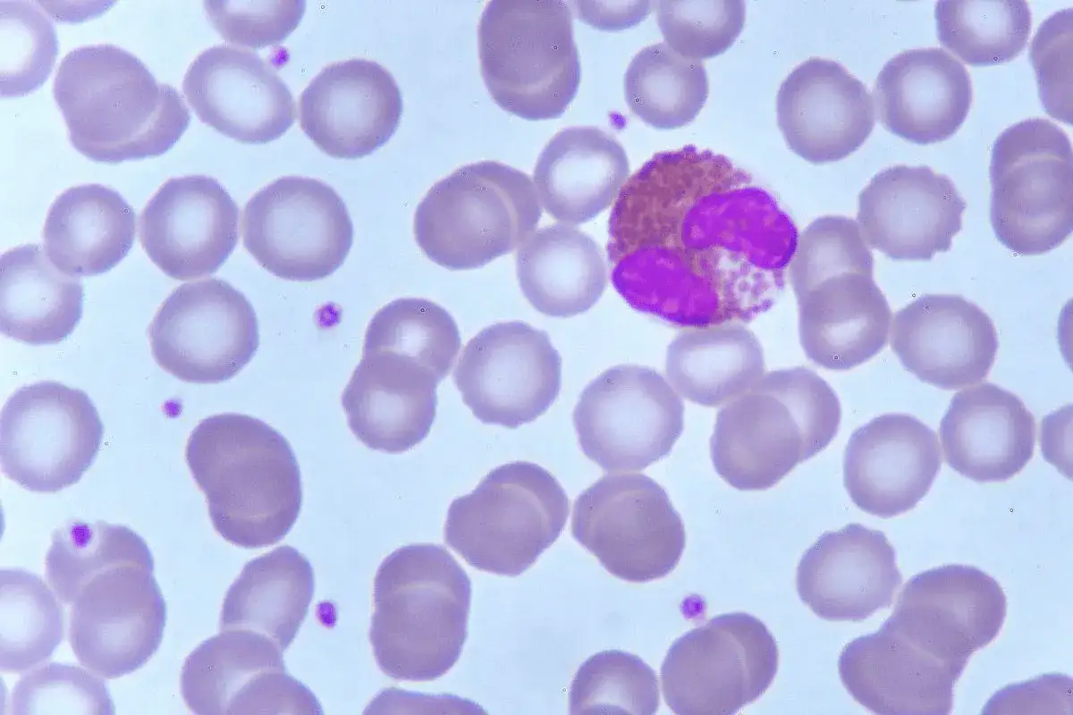 Mikroskopowy obraz krwi: widoczne liczne erytrocyty i jeden granulocyt obojętnochłonny z dwoma jądrami, sugerujący eozynofile podwyższone.