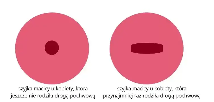 kobieta w ciąży blisko terminu porodu, kalendarz ciąży, rozwarcie szyjki macicy