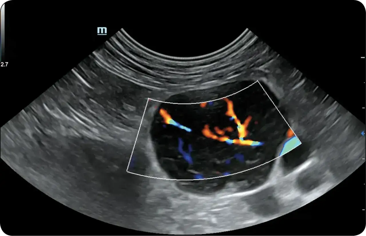 Obraz USG z kolorowym Dopplerem, pokazujący naczynia krwionośne w obrębie guza u kota. Może to być związane z IBD u kota.
