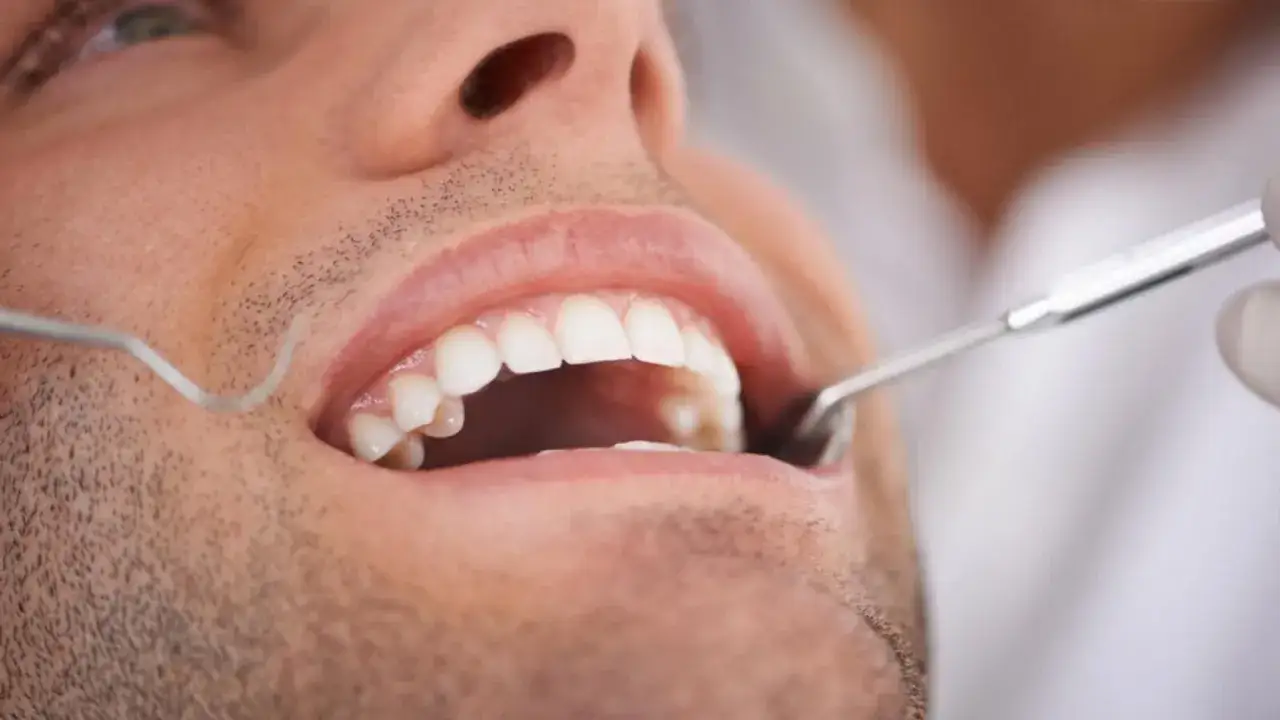 Dentysta bada zęby pacjenta. Płukanie jamy ustnej to klucz do walki z zapaleniem zęba.