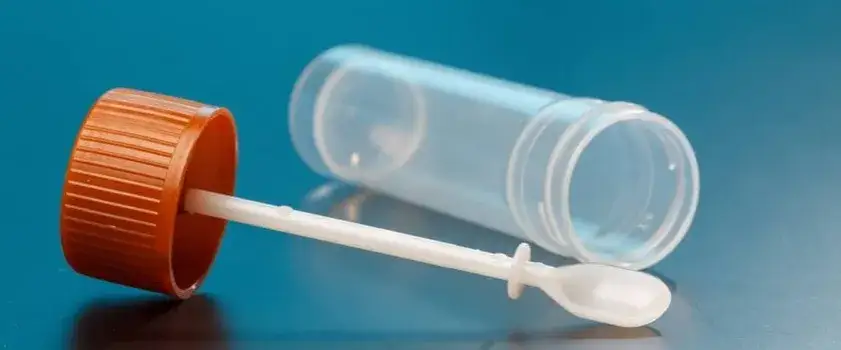 R&oacute;żne typy badań kału schemat laboratorium