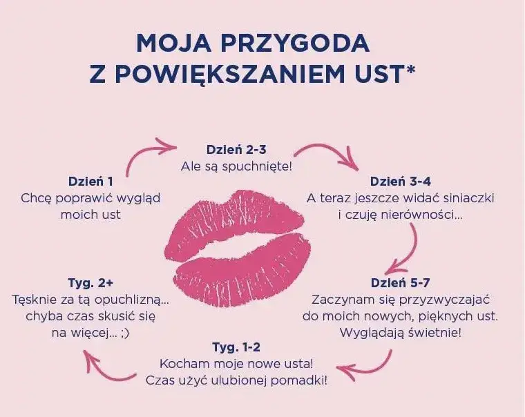 Kiedy można całować po powiększaniu ust infografika