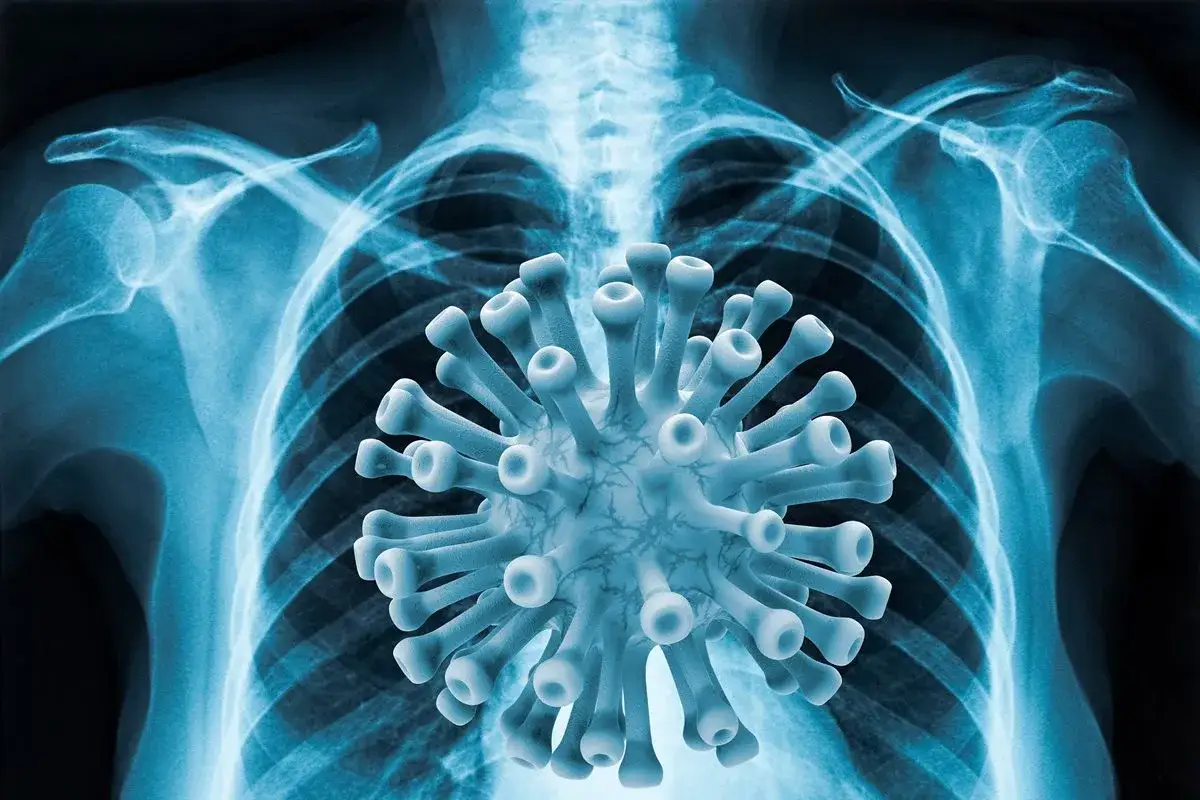 Rentgen klatki piersiowej z wirusem, symbolizującym chorobę układu oddechowego.