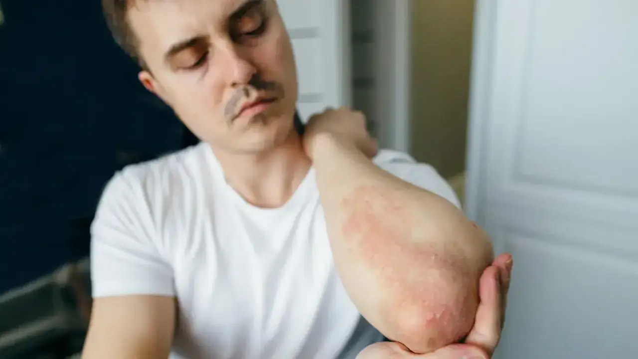 Zdjęcie Allergie Parfum Symptome: So erkennen Sie die gefährlichen Anzeichen