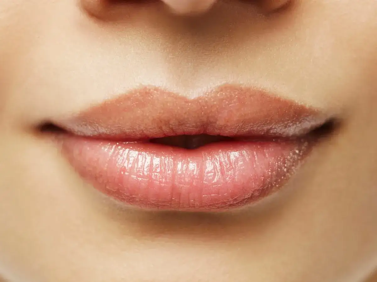 Zdjęcie Czy powiększanie ust jest bezpieczne? Poznaj ryzyka i skutki uboczne