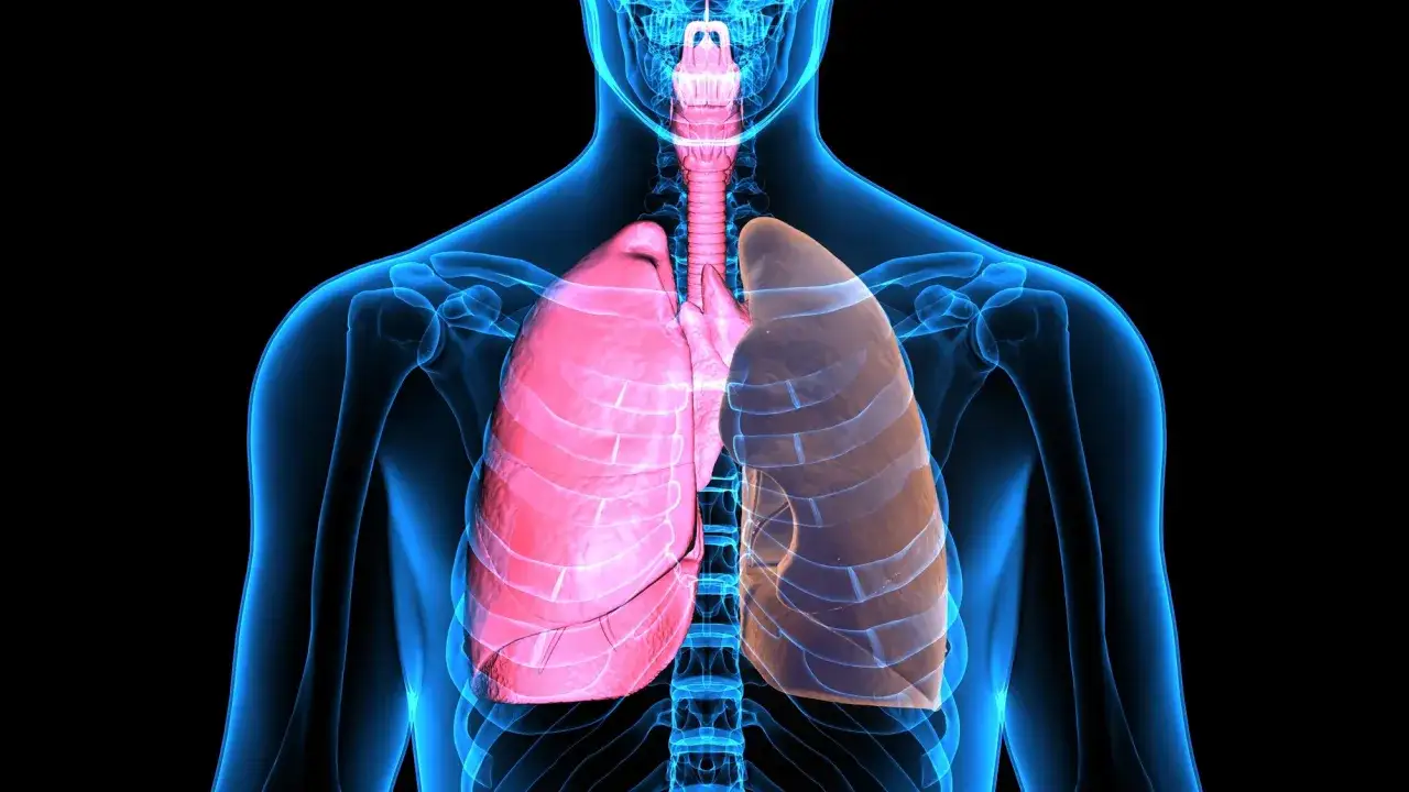 Anatomia płuc, ilustracja ukazująca przyczyny astmy. R&oacute;żowe płuco po lewej, brązowe po prawej.