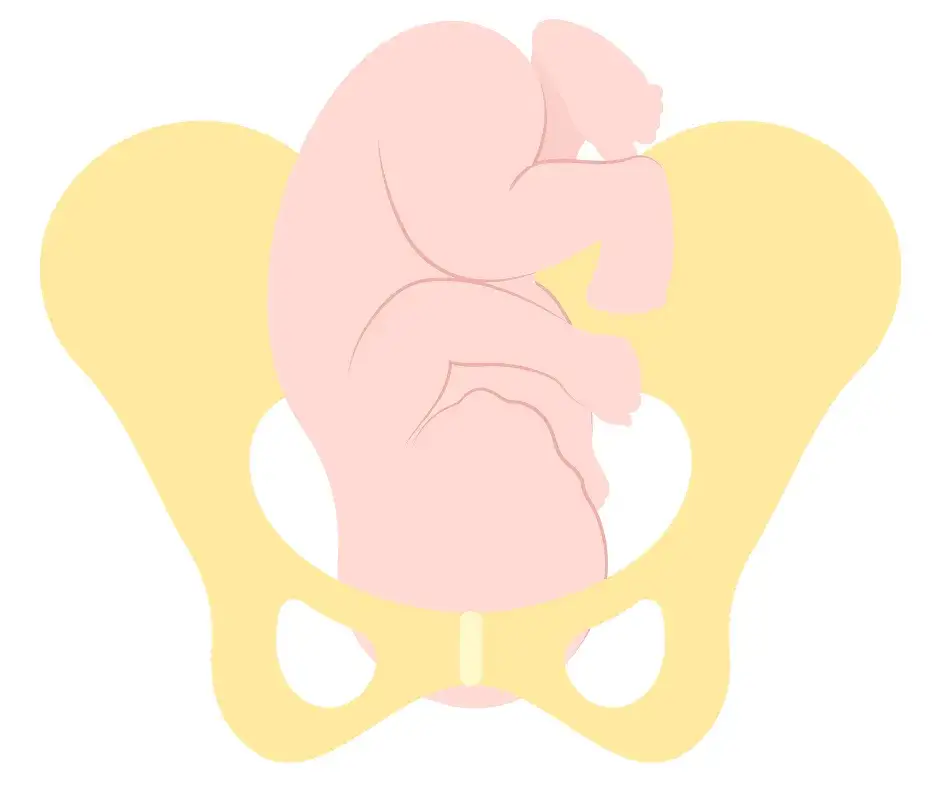 ułożenie potylicowe tylne płodu