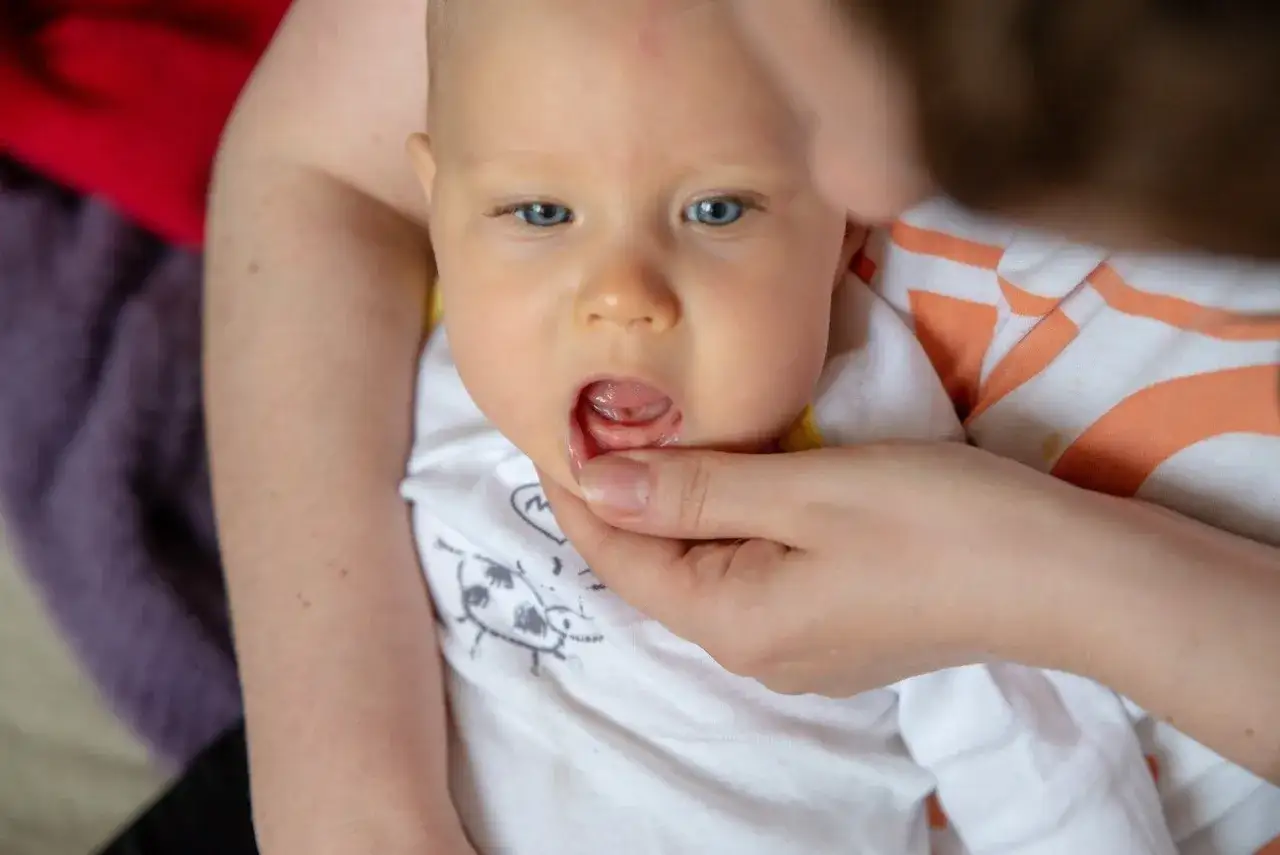 Jak wyglądają dziąsła niemowlaka podczas ząbkowania