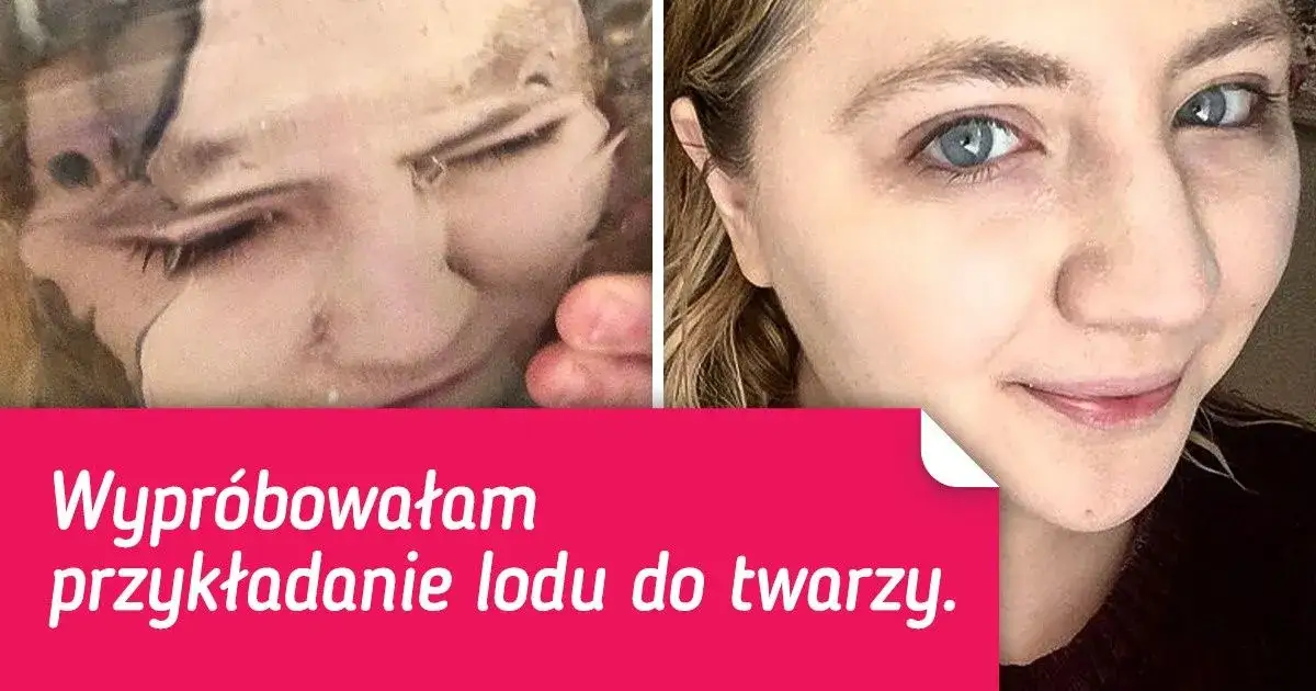 Skutki złego stosowania lodu na sk&oacute;rę