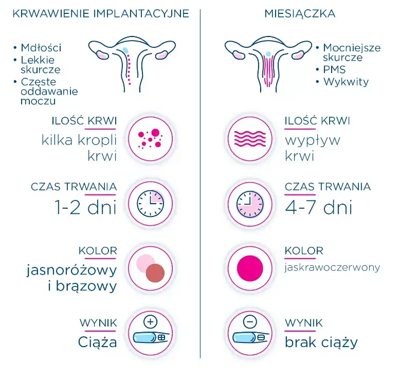 Plamienie implantacyjne vs miesiączka r&oacute;żnice