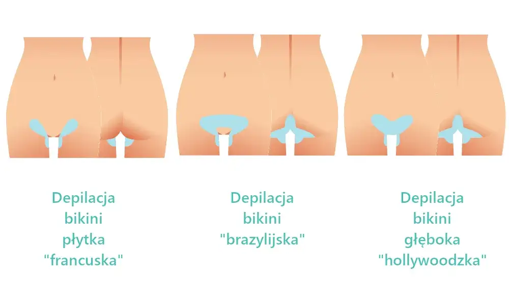 metody depilacji bikini infografika