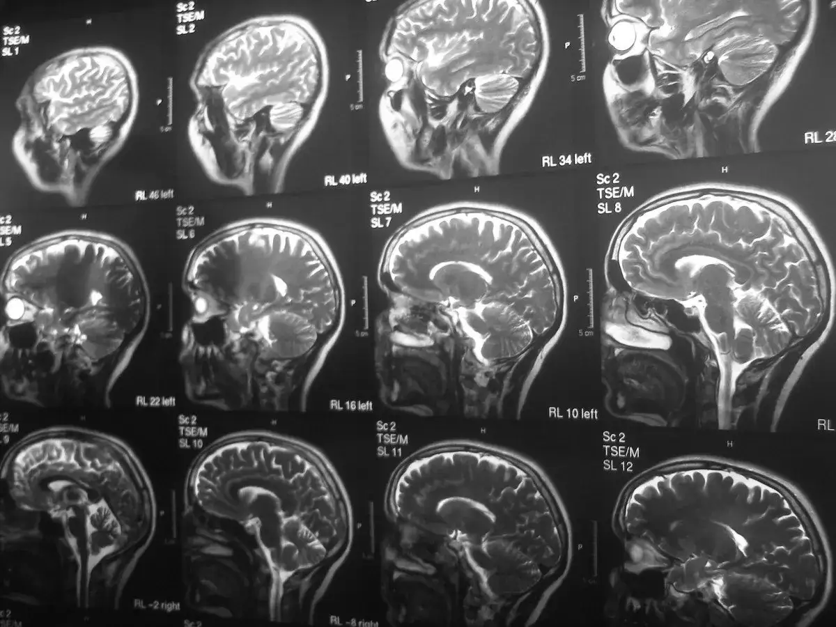 psylocybina działanie na mózg