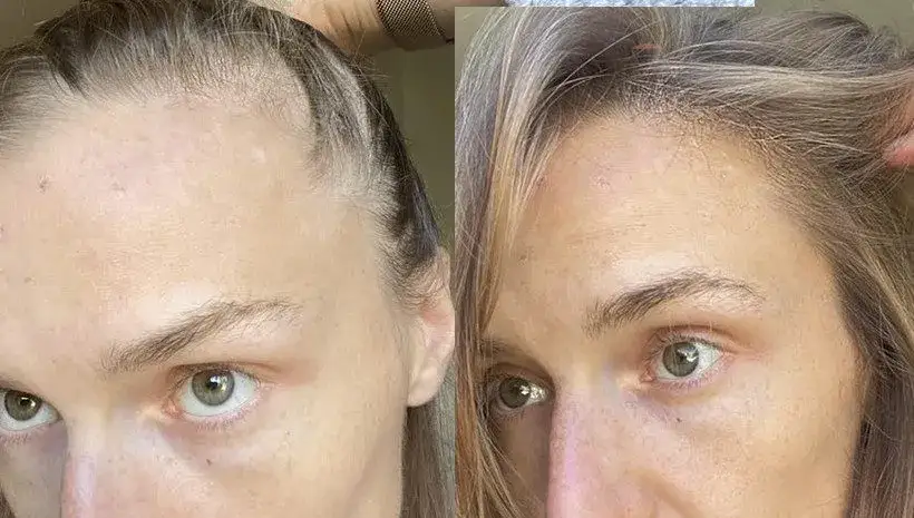 Onlybio wcierka przed i po efekty