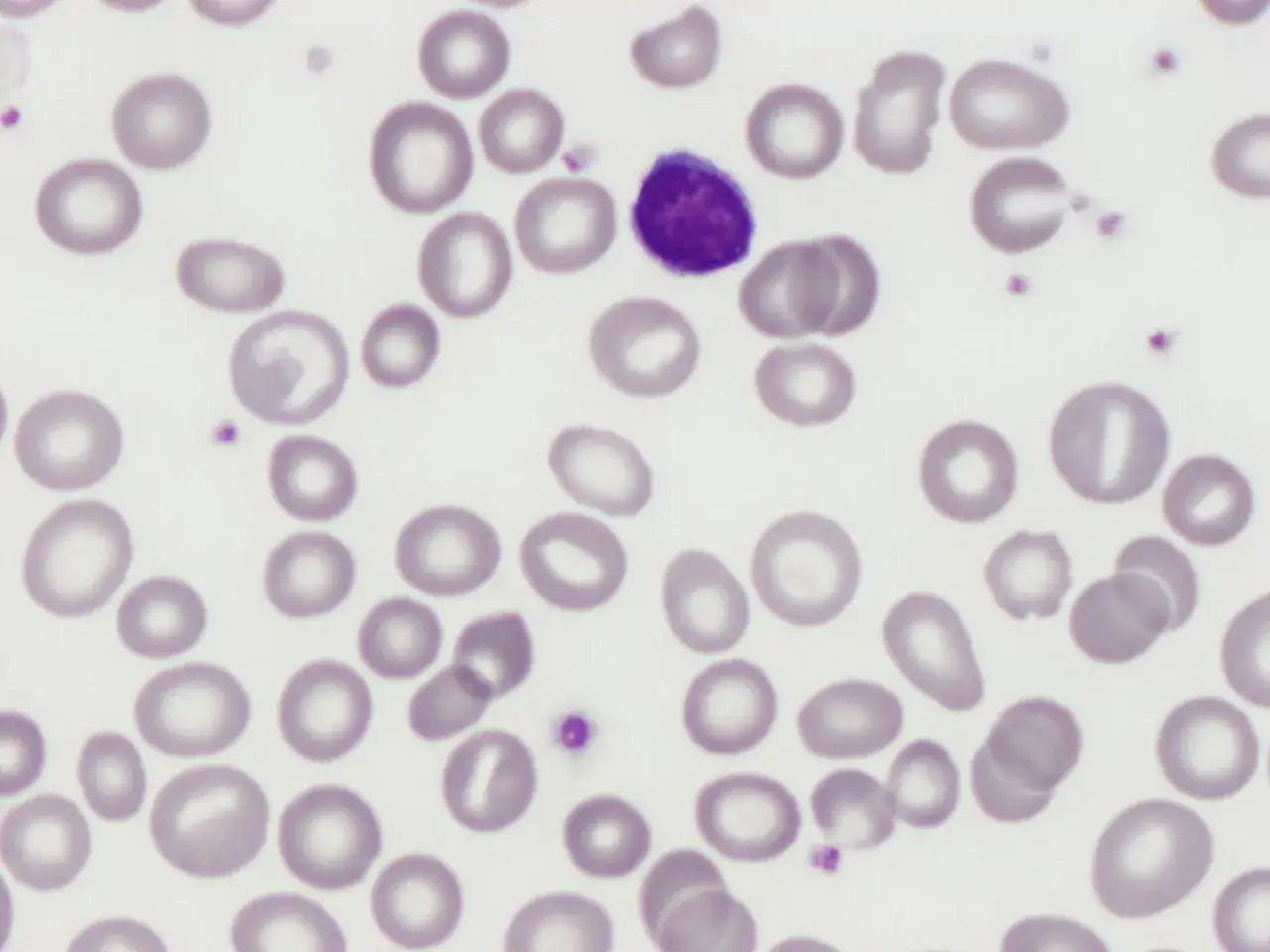 Makrocyty mikrocyty por&oacute;wnanie