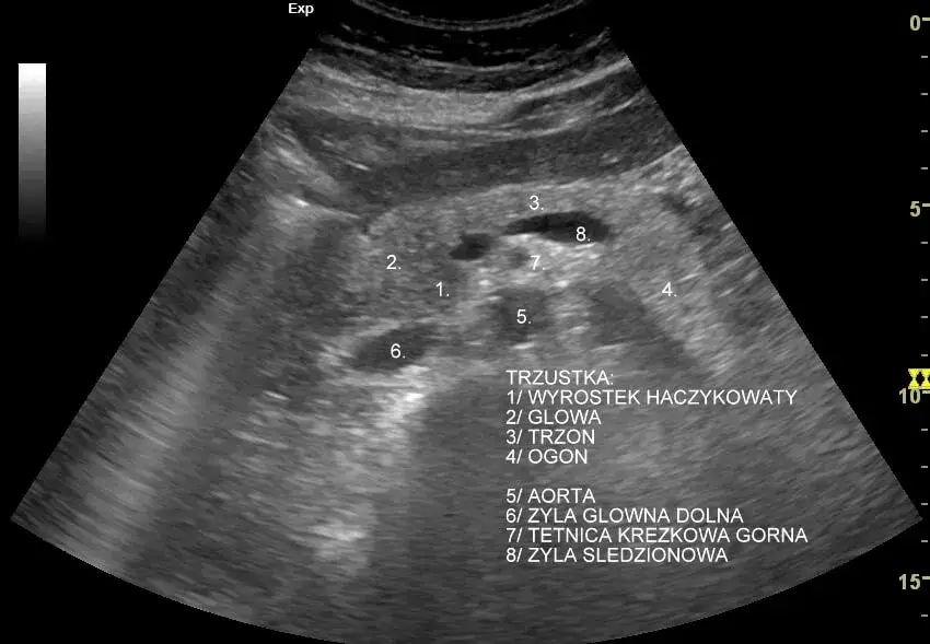 badanie USG jamy brzusznej trzustka