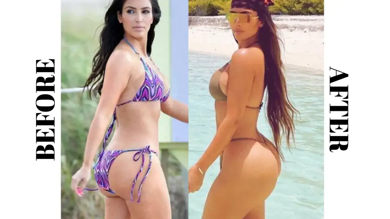 Kim Kardashian przed i po BBL porównanie