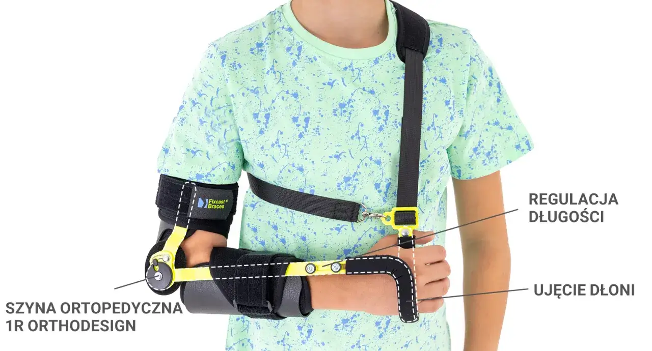 Orteza na rękę po złamaniu kości promieniowej. Szyna ortopedyczna 1R Orthodesign z regulacją długości i ujęciem dłoni.