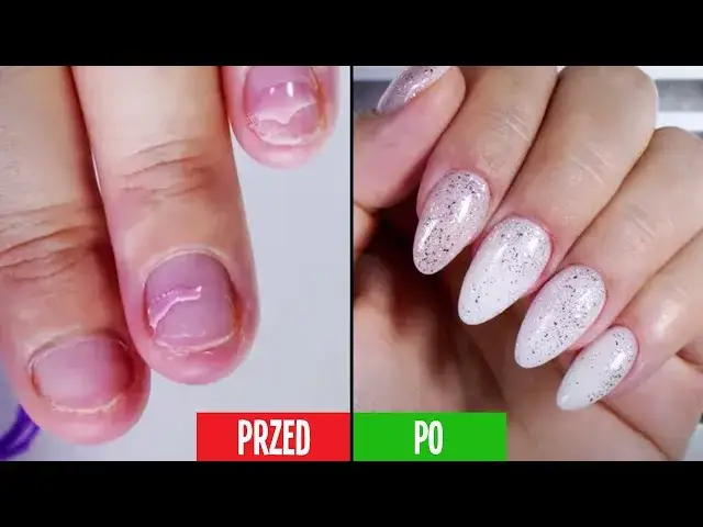 przedłużanie paznokci po obgryzaniu przed i po