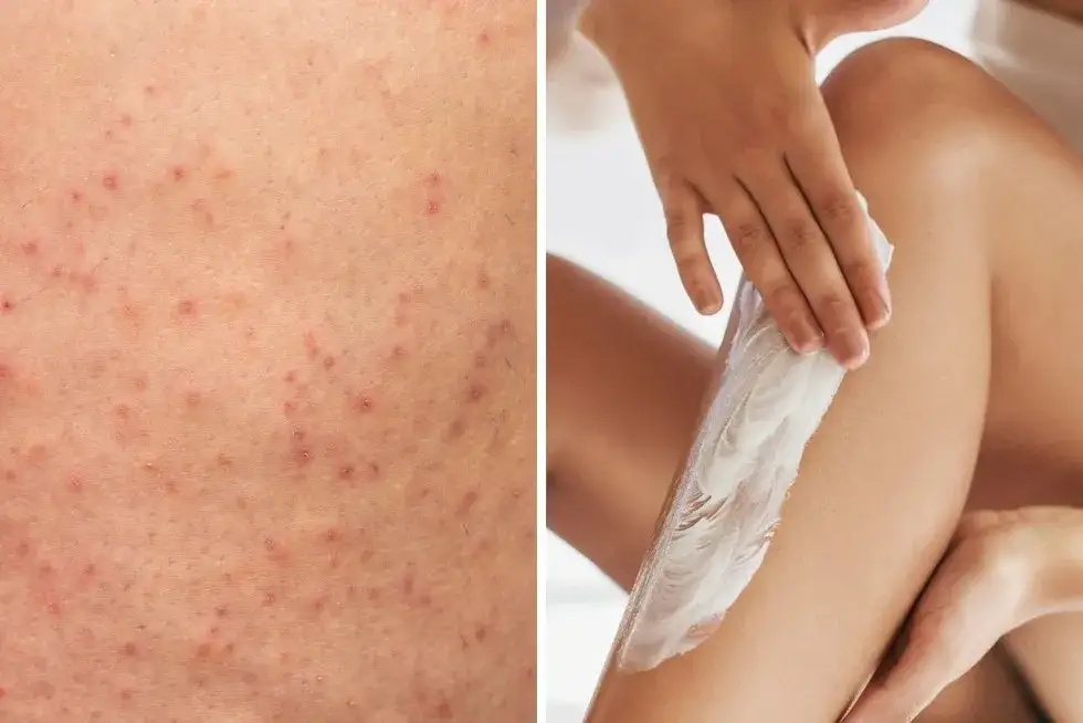 pielęgnacja sk&oacute;ry po depilacji kremem