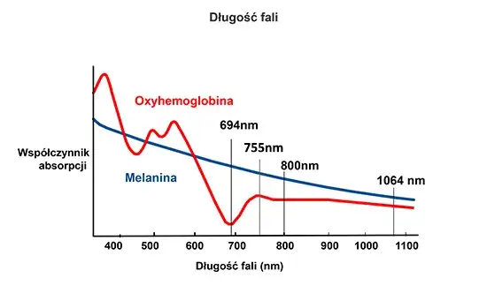 Porównanie laserów do depilacji diodowy aleksandrytowy Nd:YAG