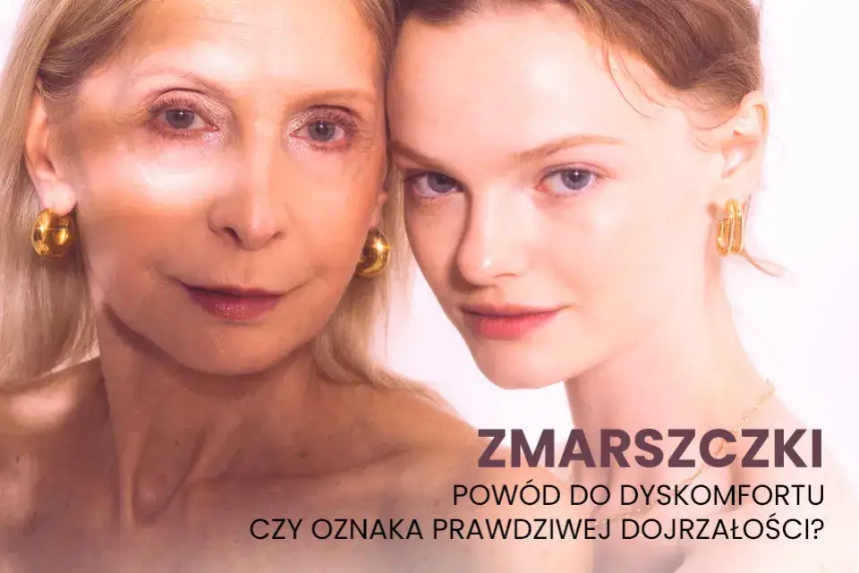 Kobieta po 30. roku życia z drobnymi zmarszczkami mimicznymi