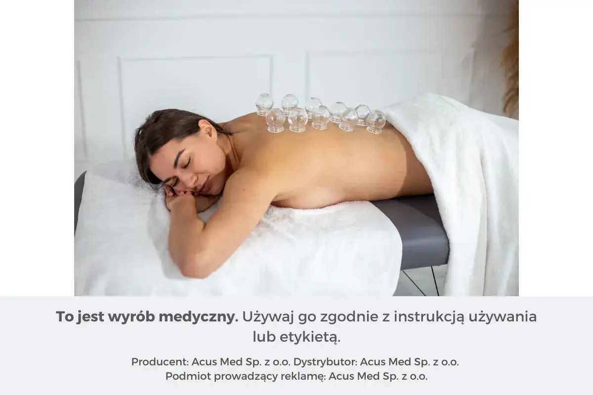 Kobieta leży na plecach z bańkami na zatoki umieszczonymi na plecach.