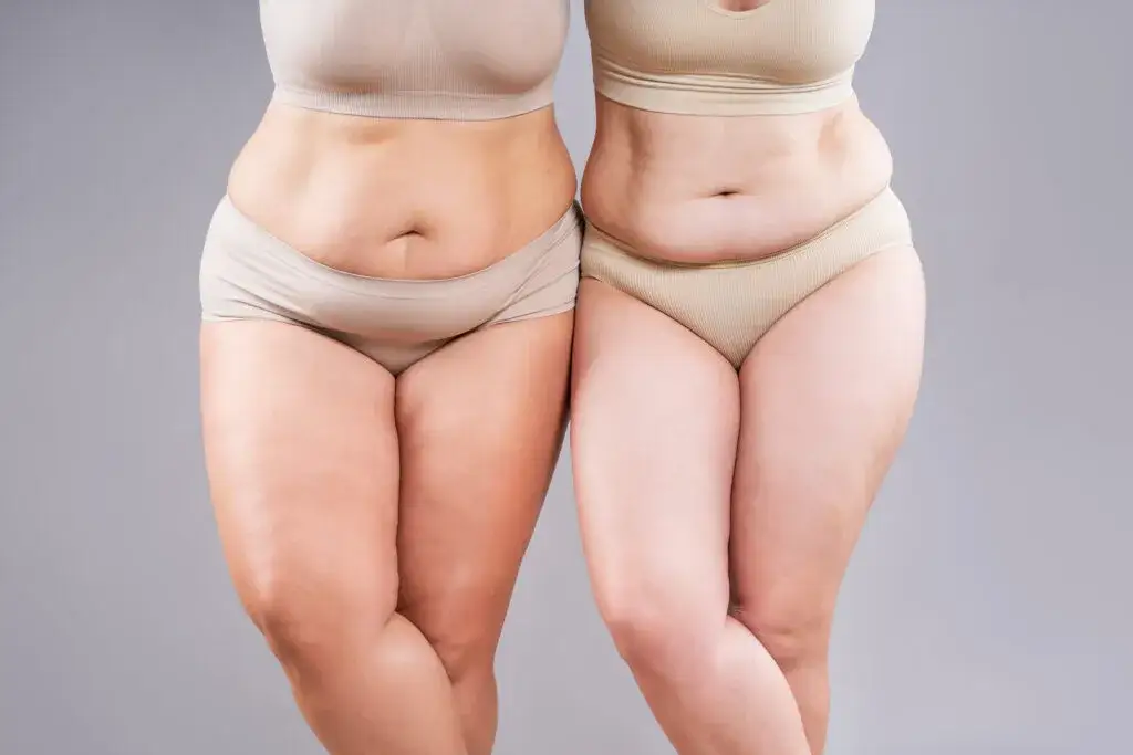 Zdjęcie Ile tłuszczu na redukcji jest optymalne? Sprawdź, jak uniknąć błędów i schudnąć zdrowo!