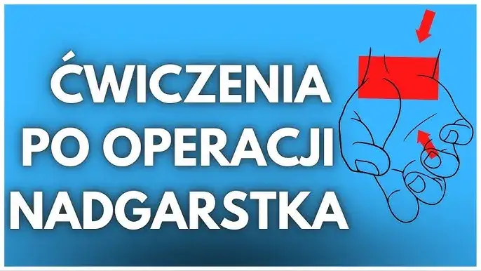 ćwiczenia mobilizujące bliznę po operacji nadgarstka, ćwiczenia wzmacniające chwyt po operacji cieśni nadgarstka