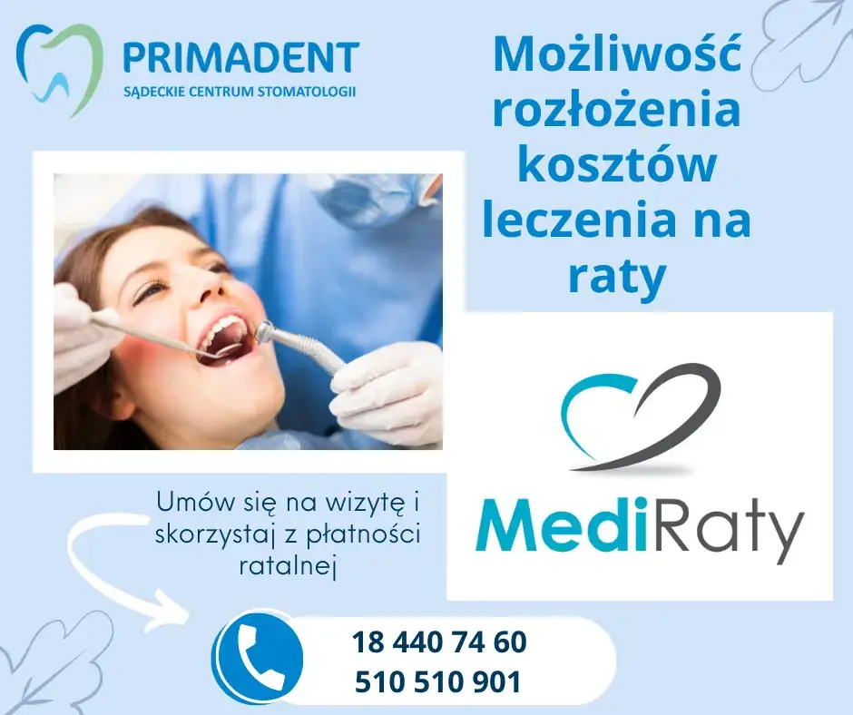 Płatności ratalne w stomatologii