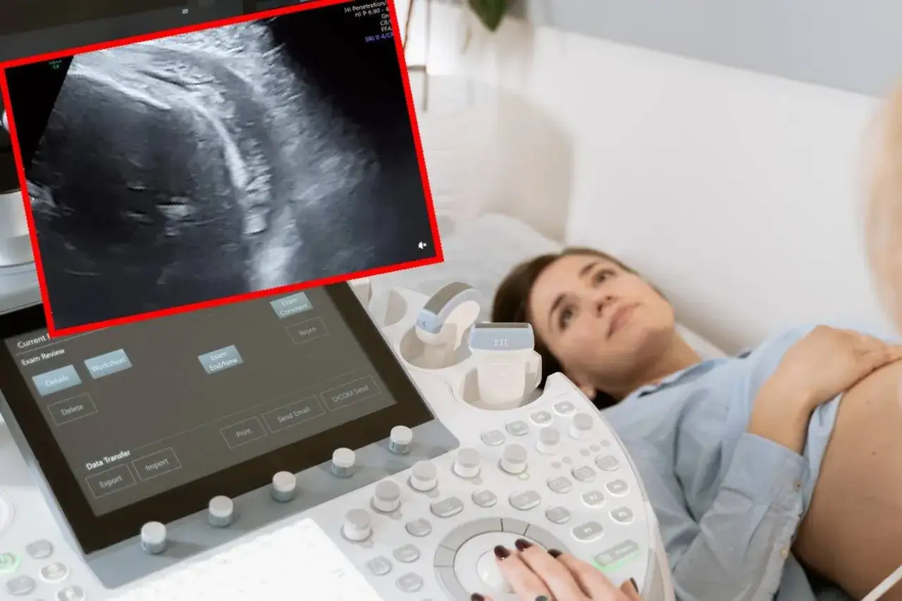 Pierwsze badanie prenatalne: jak się przygotować? Kobieta leży na kozetce, obok aparat USG z obrazem płodu.