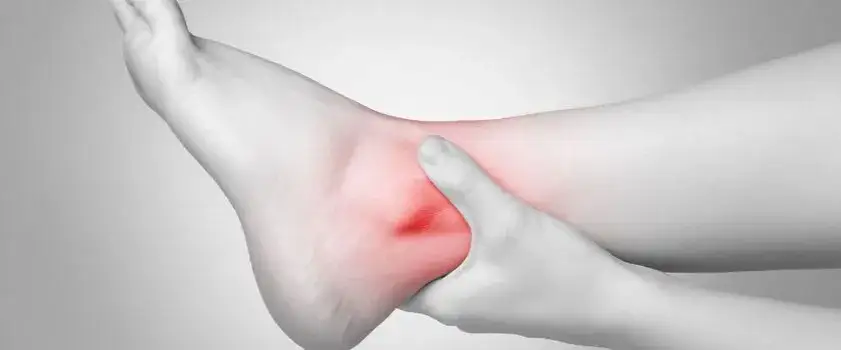 Zdjęcie Jak długo trwa opuchlizna po skręceniu kostki? Sprawdź, co musisz wiedzieć