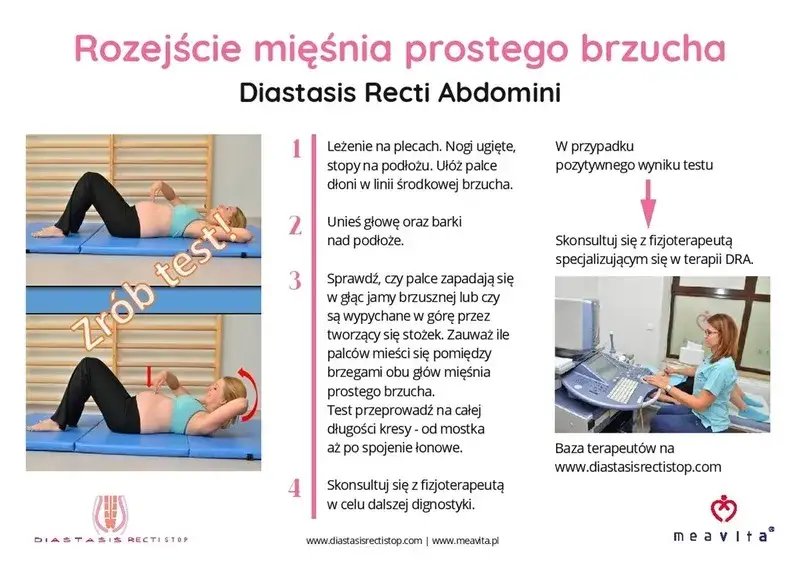 Rozejście mięśnia prostego brzucha test