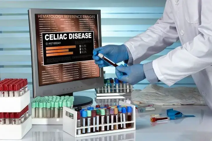 badania diagnostyczne celiakia nietolerancja laktozy, test oddechowy, biopsja jelita
