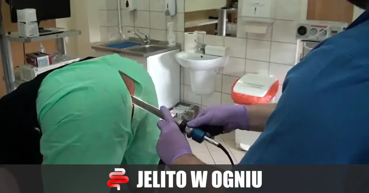 anoskopia rektoskopia kolonoskopia schemat