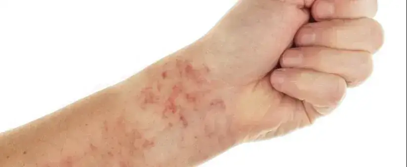 badania diagnostyczne b&oacute;l kości swędzenie sk&oacute;ry