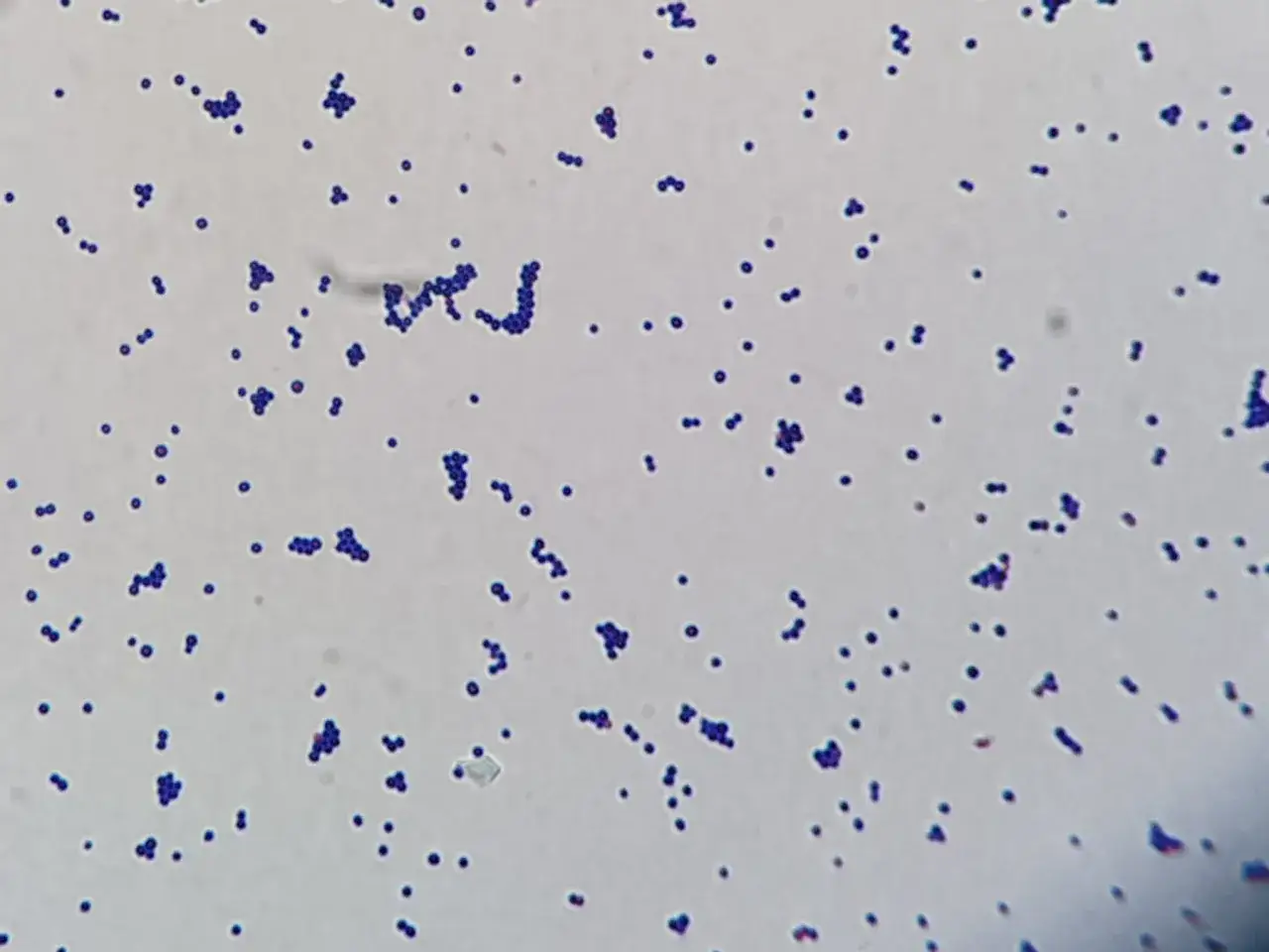 przykłady bakterii gram dodatnich i ujemnych mikroskop