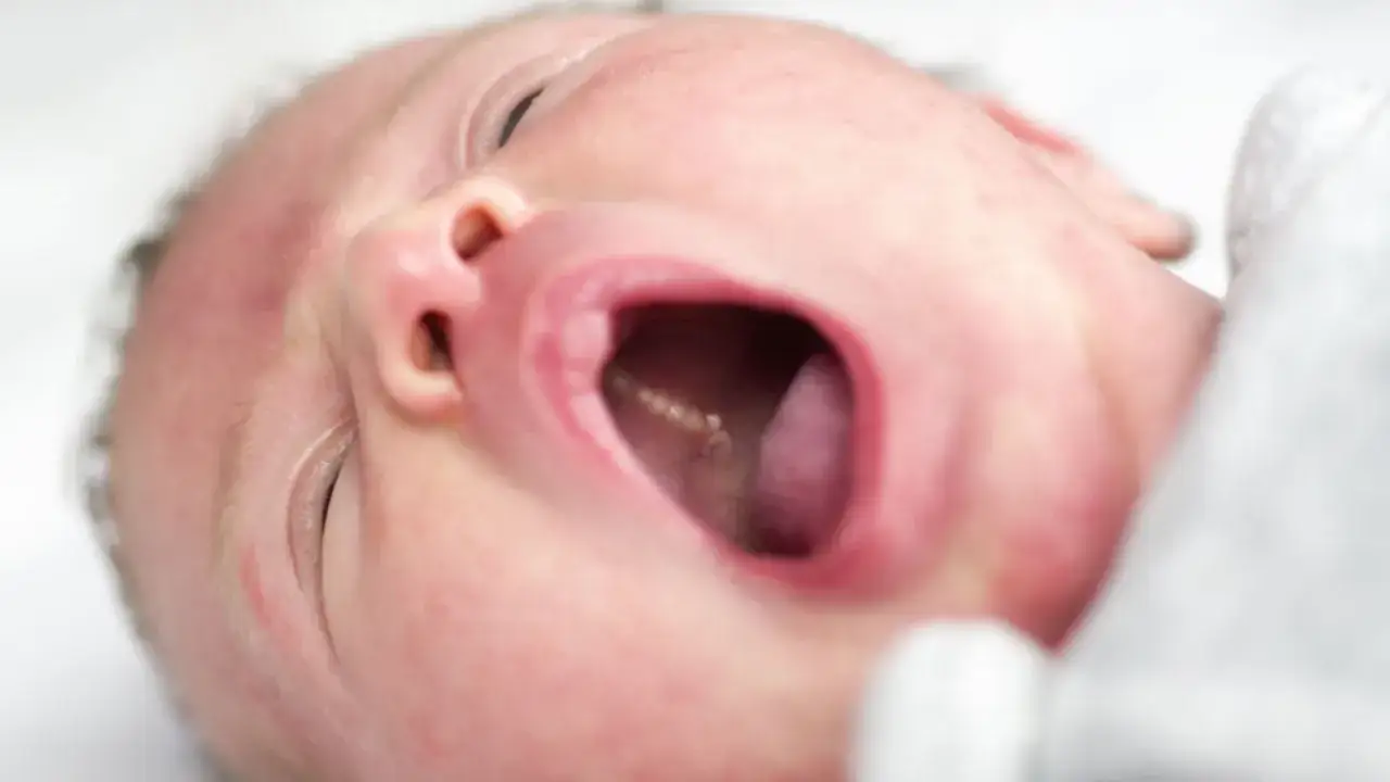 Usta niemowlaka otwarte, widać małe ząbki i zaczerwienienie, kt&oacute;re może sugerować pleśniawki u niemowlaka.