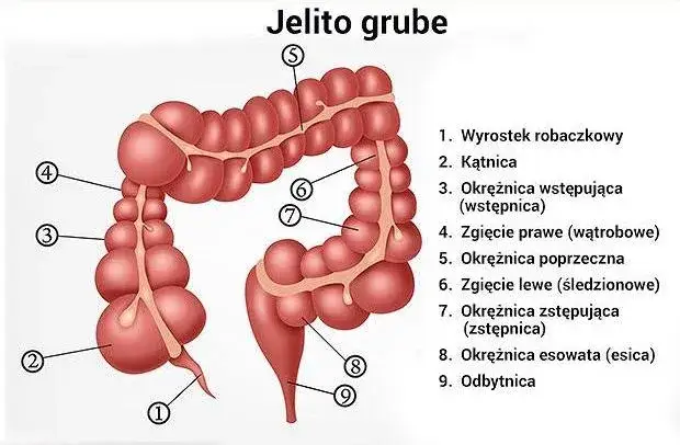 Choroby jelita grubego schemat