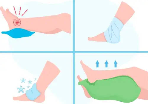 Pierwsza pomoc skręcona kostka infografika RICE