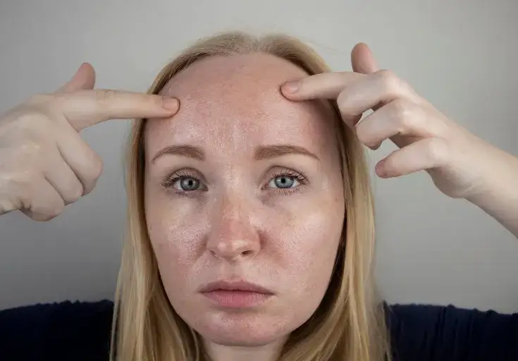 Zdjęcie Effektive Tipps gegen fettige Gesichtshaut für matte, klare Haut