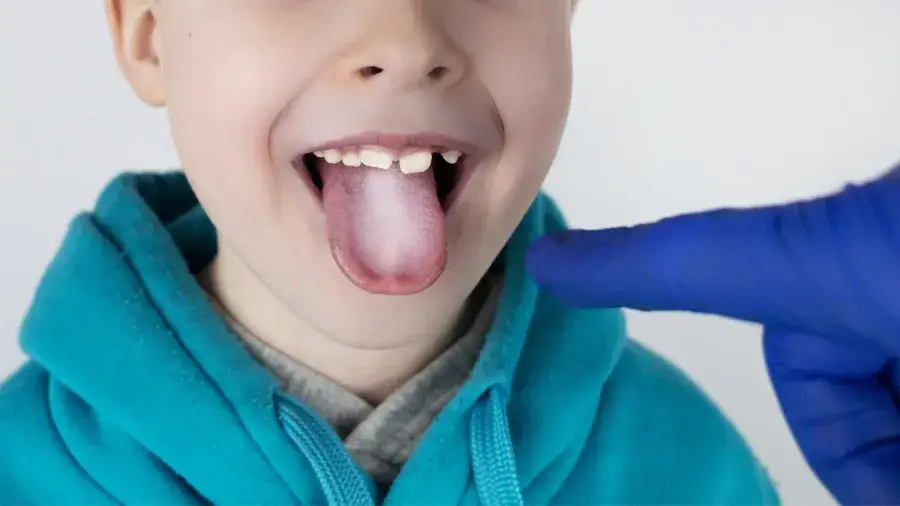 Zdjęcie Jak odgrzybić organizm dziecka - skuteczne metody i porady dla rodziców