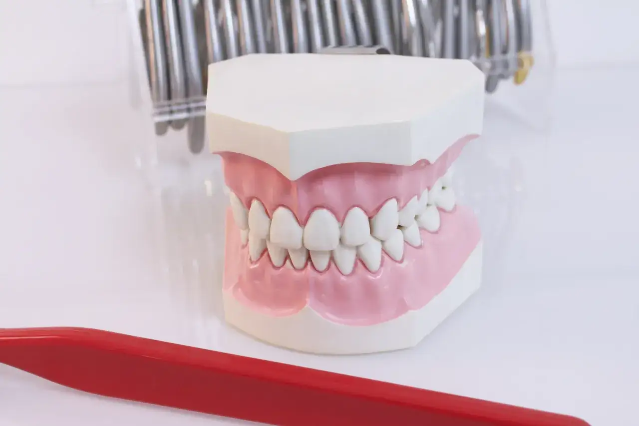Model szczęki z zębami i czerwoną szczoteczką. Przypomina o problemie paradontozy, kiedy wypadają zęby.