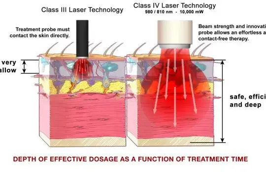 schemat działania lasera w komórce rehabilitacja