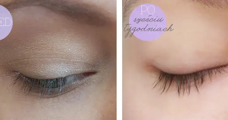 olejek rycynowy na rzęsy