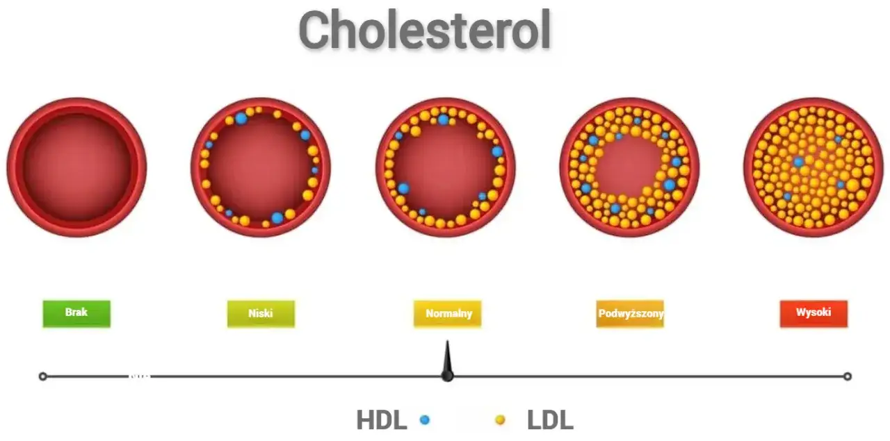 Zdjęcie Jak obliczyć cholesterol LDL i uniknąć problemów zdrowotnych