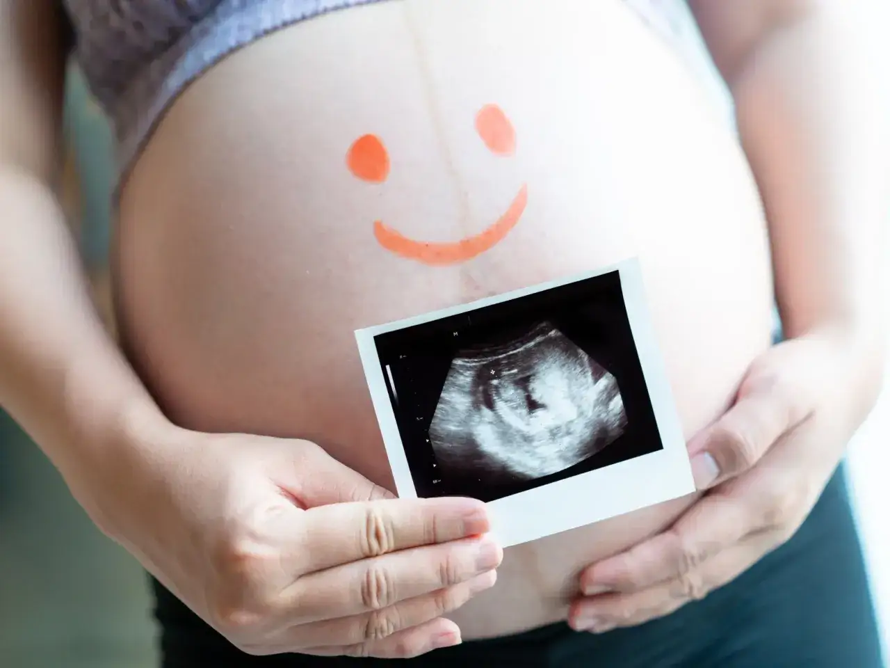 Brzuszek z uśmiechniętą buźką i zdjęciem USG. Czy można prowadzić ciążę na NFZ i prywatnie?