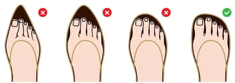 buty odpowiednie haluksy